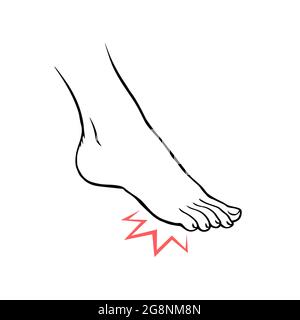 Leg with heel pain. Orthopedic disease. Foot health problems. Vector isolated outline illustration hand drawn Stock Vector