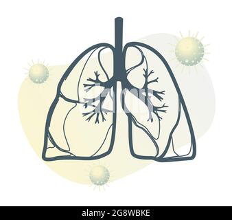 Covid-19 Impact on Human Lungs - PULMONARY EDEMA - Illustration as EPS 10 File Stock Vector