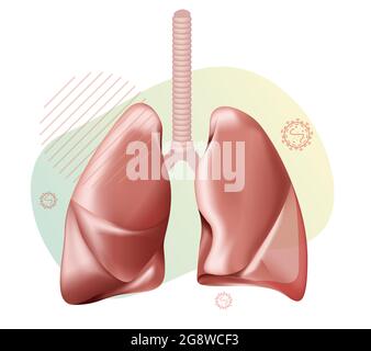 Covid-19 Impact on Human Lungs - PULMONARY EDEMA - Illustration as EPS 10 File Stock Vector