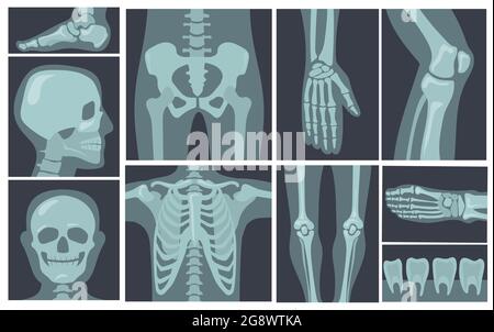 illustration of human x - ray film Stock Vector Image & Art - Alamy