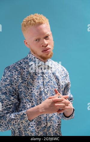 Studio portrait of albino man in blue patterned shirt Stock Photo