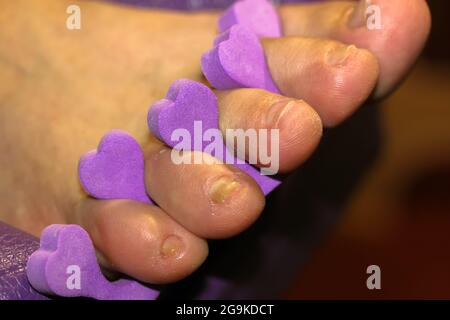 Women's foot, female fingers up close and purple toe divider, separator in a form of small hearts - a tool necessary for the work of a pedicurist mast Stock Photo