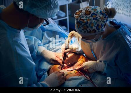 Top view of doctors performing abdominoplasty surgery in clinic. Male plastic surgeon and female assistant doing abdominal plastic surgery in operatin Stock Photo