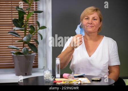 Woman senior aged in medical mask wearing white t-shirt sitting at the table having acne remedy on the table, which she is getting to use to stop the Stock Photo