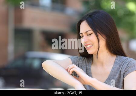 Stressed asian woman scratching itchy arm in the street Stock Photo