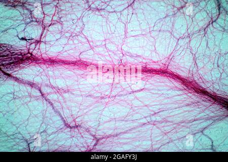 Areolar connective tissue, light micrograph Stock Photo