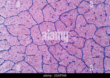 Human eye nerve, light micrograph Stock Photo