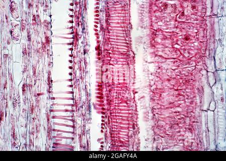 Plant vascular tissue, light micrograph Stock Photo