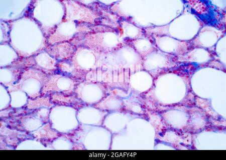 Human lung tissue, light micrograph Stock Photo