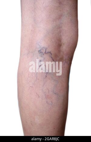 Southeast Asian, Myanmar old woman’s leg. Skin creases, loosen and thin skin and varicose veins show aging. Isolated on white background. Stock Photo