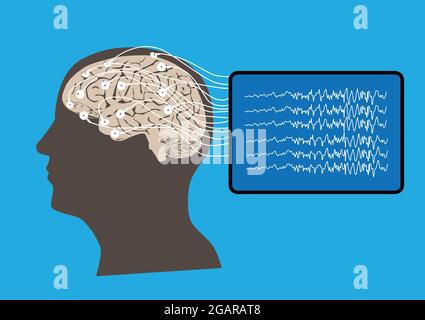 Illustration of human brain and electroencephalography or EEG recording and brain waves Stock Vector