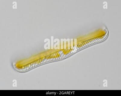 Freshwater diatom, Rhopalodia sp., under the microscope Stock Photo