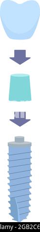 The dental scheme with arrows as a crown is installed on the abutment, and then on the dental implant. vector illustration, in a flat style with a thin line.Inside the oral cavity, the gums, the roots. Stock Vector