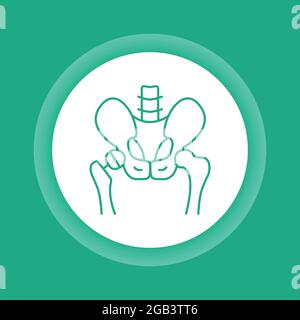 Arthroplasty color button icon. Hip replacement implant installed in the pelvis bone. Isolated vector element. Stock Vector