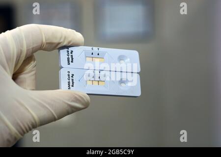 Positive and negative results of SARS-CoV-2 Rapid Antigen AG test done by a nasal swab held by a medical personnel, Covid-19 coronavirus rapid Antigen Stock Photo