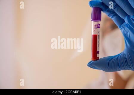 A doctor's hand holding a bottle of blood sample. Stock Photo