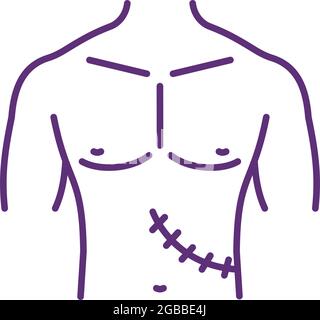 Removed organ aftermath RGB color icon Stock Vector