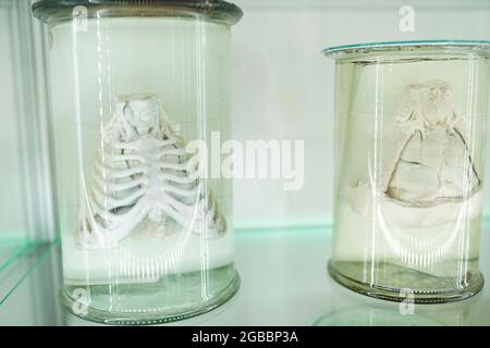 human organs in formalin in anatomical museum Stock Photo