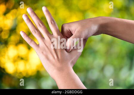 Acupressure Alternative Therapy For Muscle Pain and Other Problem Stock Photo