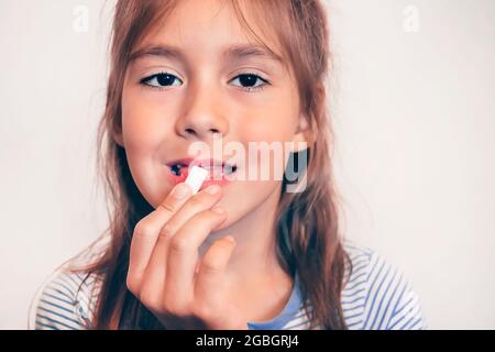 Close up of unhealthy baby teeth. Girl open mouth showing caries teeth ...