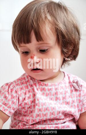 Close up portrait baby girl with a scratch on her nose isolated on the white background. Child safety concept, injuries from falling down Stock Photo