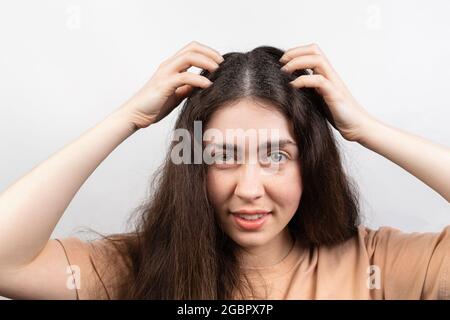 Dandruff and lice. Portrait of a young Caucasian woman, a brunette, who scratches her head with her hands.White background. Stock Photo