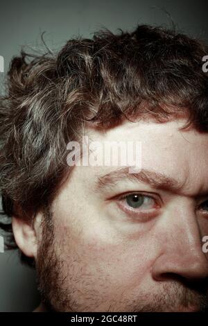 detail of blue eye of man with veins in the scrotal area Stock Photo