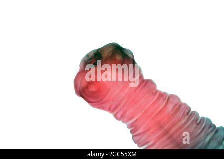 Tapeworm, light micrograph