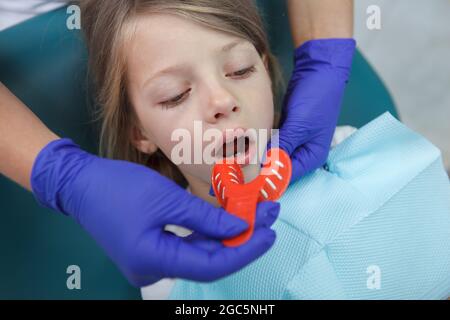 Dentist putting putty stone into patient mouth for dental