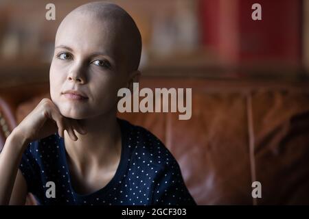 Serious thoughtful ill hairless cancer patient portrait Stock Photo