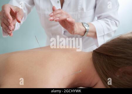 Doctor puts needles into female back on the acupuncture treatment therapy in spa salon. Alternative Medicine concept