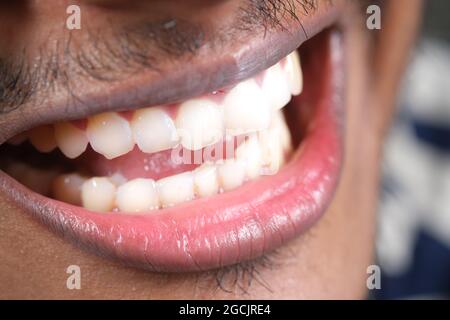 young man open mount checking his teeth  Stock Photo