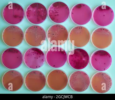 Petri Dish With Various Bacteria Colonies On Agar Stock Photo - Alamy