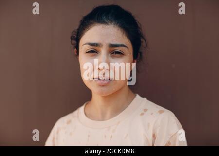 Stressed woman suffering of heatstroke refreshing with cold water outside. Weather abnormal exreme heat concept Stock Photo