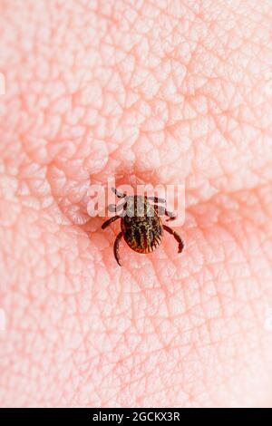 insect bite close-up on the skin. Allergic reaction. Diseases and ...