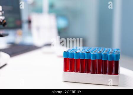 Blood sample ready for biological examination during microbiology ...