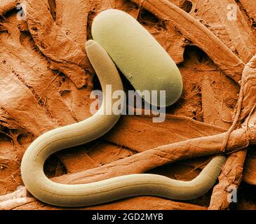 Low-temperature scanning electron micrograph of soybean cyst nematode and its egg. Magnified 1,000 times. ca. 24 July 2006 Stock Photo