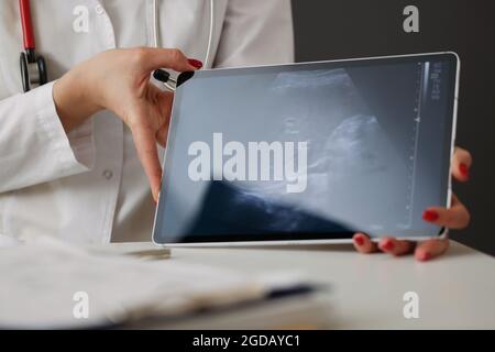 Doctor showing abdominal ultrasound scan on digital tablet in clinic closeup Stock Photo