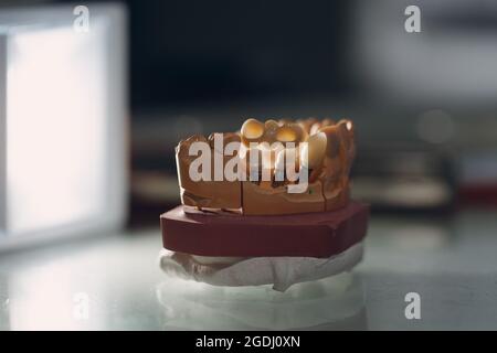 Dental layout of the human jaw with teeth and implants Stock Photo - Alamy