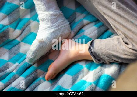Child with bandage on leg heel fracture. Broken right foot, splint of toddler. Little boy sleeping on a blue blanket.  Stock Photo