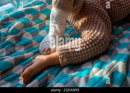 Child with bandage on leg heel fracture. Broken right foot, splint of toddler. Little boy sleeping on a blue blanket.  Stock Photo