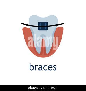 Vector flat illustration of a tooth with brace Stock Vector