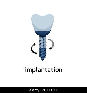 Flat vector icon of a tooth implant. Dental implantation Stock Vector