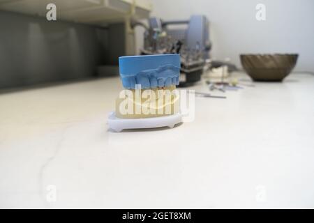 plaster models of jaws at the dental technician workplace Stock Photo