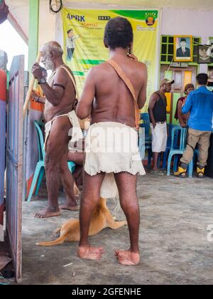 Bird's Head Peninsula, West Papua, Indonesia, Asia - Feb 2018: A person with leg deformities due to polio or other diseases in the middle of the Indon Stock Photo