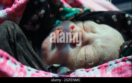 Beautiful baby boy a few seconds after the birth. Baby after birth. Stock Photo