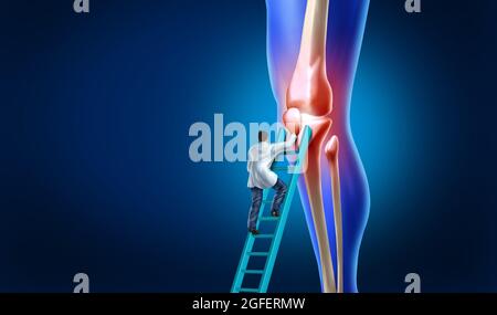 Knee pain care with the anatomy of a skeleton leg and showing the inside inflamation as painful joint that needs surgery by an orthopedic surgeon. Stock Photo