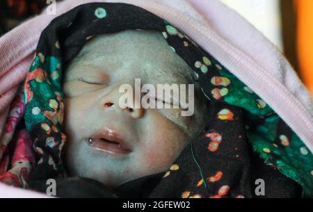 Beautiful baby boy a few seconds after the birth. Baby after birth. Stock Photo