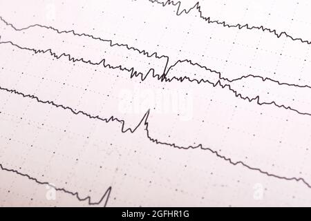 Electroencephalogram graph on a white paper close up Stock Photo