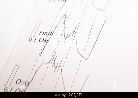 Research schedule Rheoencephalography on a white paper Stock Photo